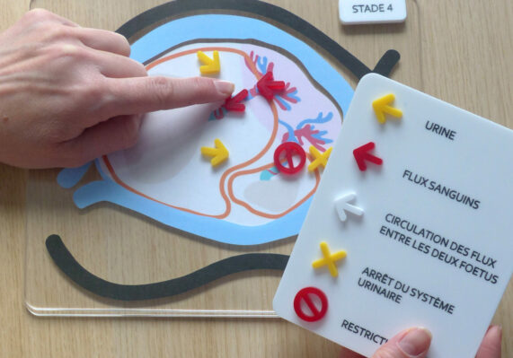 Design outils éducation thérapeutique