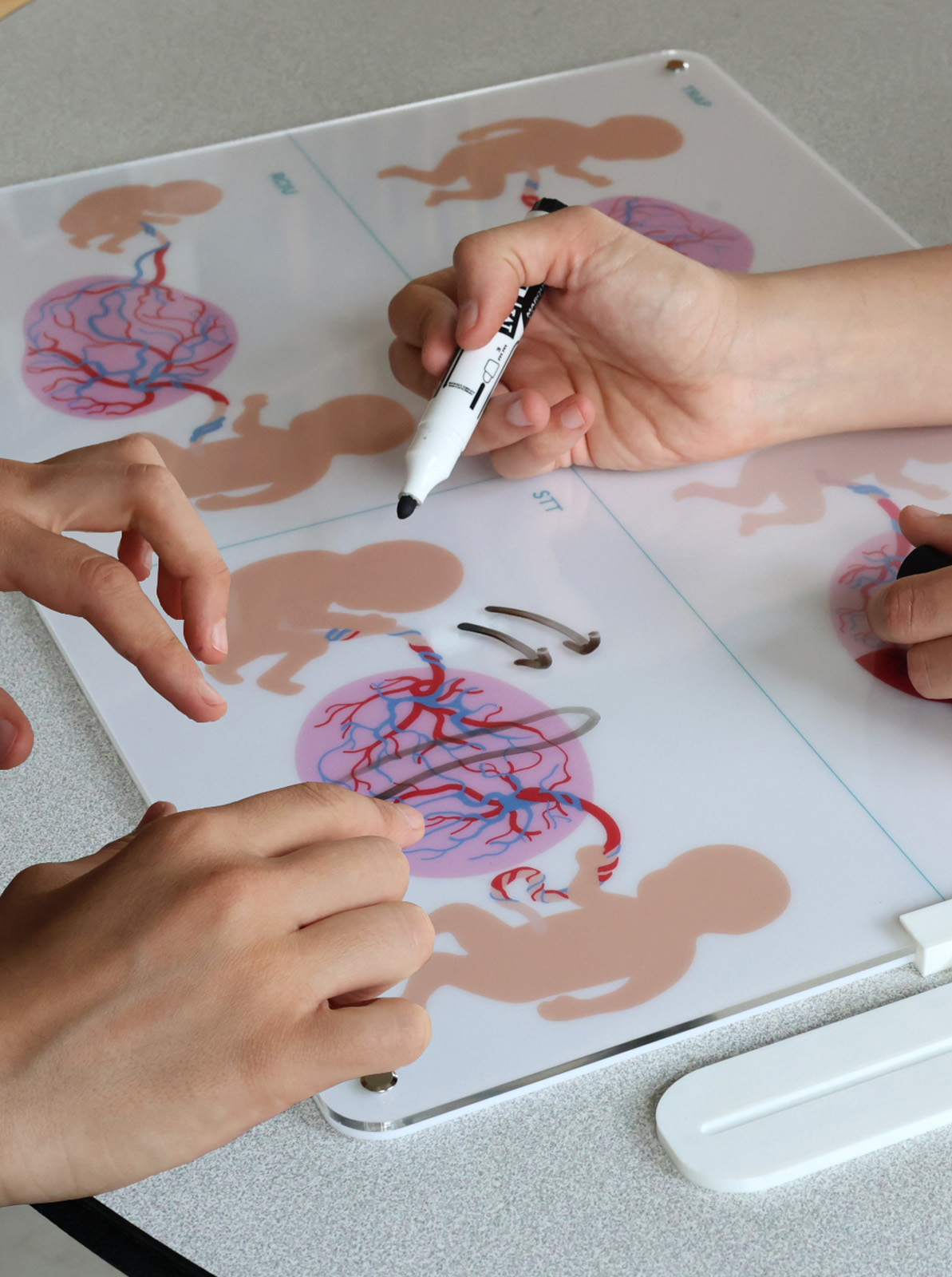 fablab hospitalier éducation thérapeutique patient design